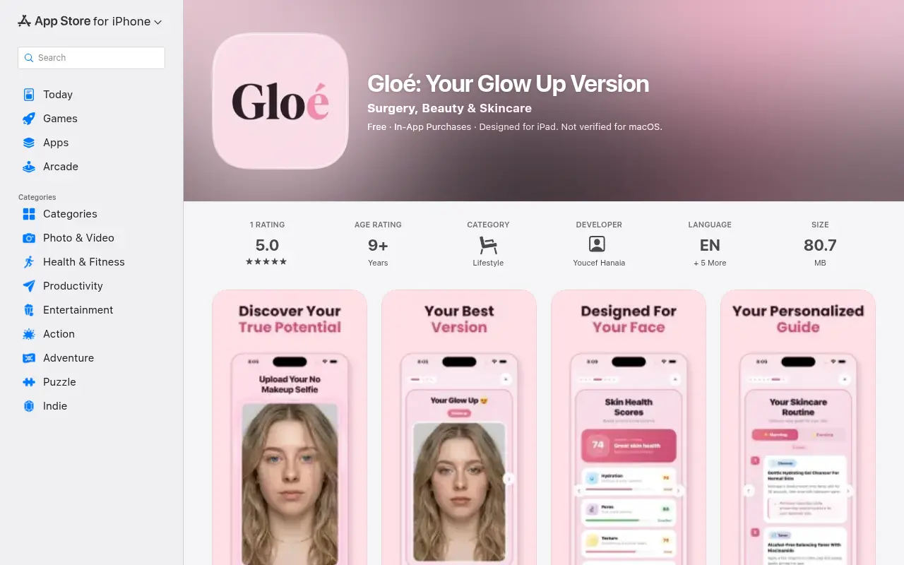 Gloé